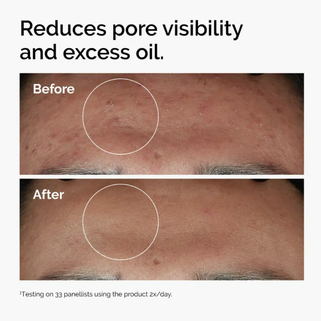 NIACINAMIDA+ZINC+ACIDO HIALURONICO 30 ml